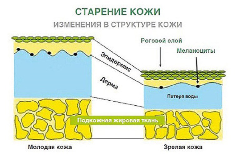 Менен кожа. Процесс старения кожи. Старение кожи схема. Факторы старения кожи. Изменение структуры кожи.